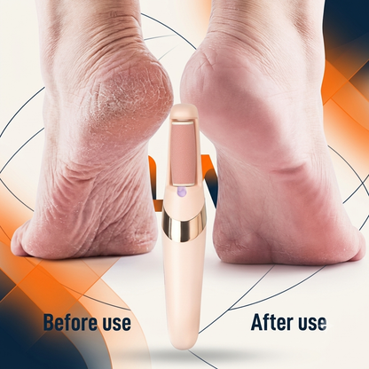 Electric Pedicure Callus Remover for Smooth Feet